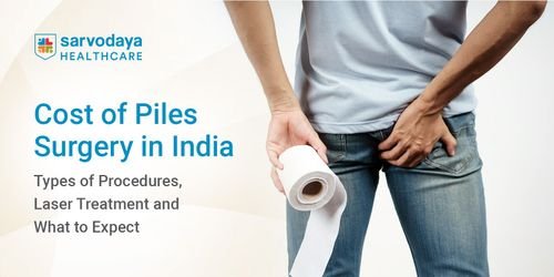 Cost of Piles Surgery in India: Types of Procedures, Laser Treatment and What to Expect